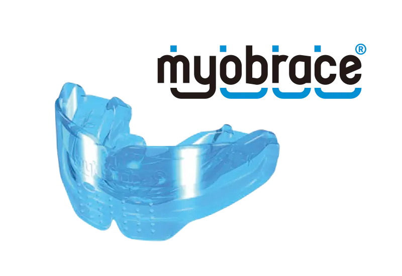 マイオブレース