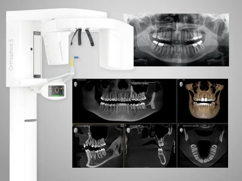 歯科用CT・デジタルレントゲン