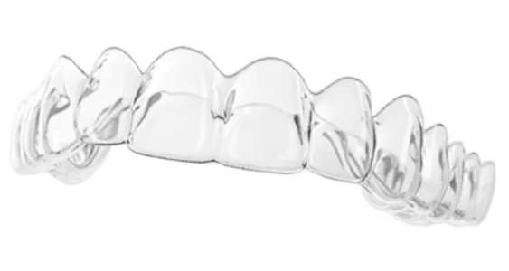 マウスピース矯正